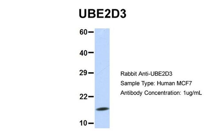 UBE2D3 Antibody in Western Blot (WB)