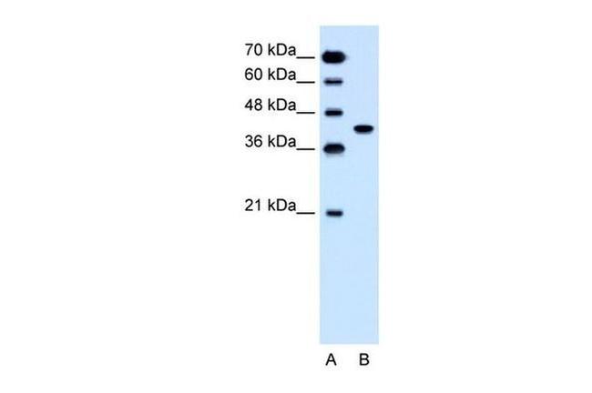 SLC35B1 Antibody in Western Blot (WB)