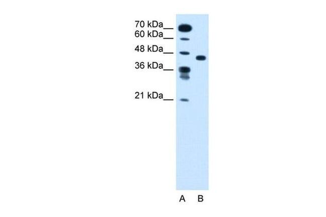 SLC35C1 Antibody in Western Blot (WB)