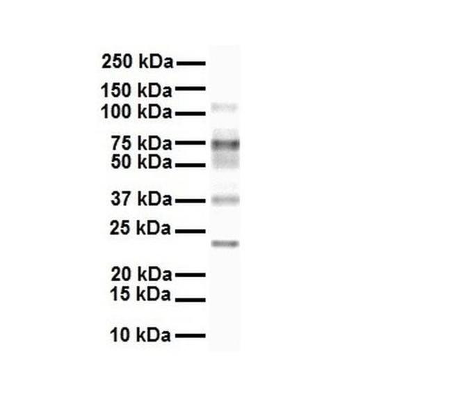 SLC27A3 Antibody in Western Blot (WB)