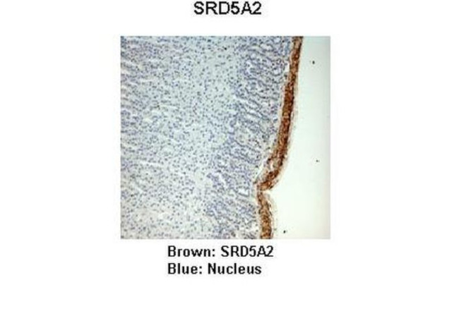 SRD5A2 Antibody in Immunohistochemistry (IHC)