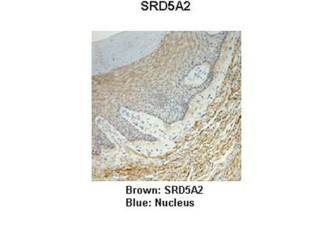 SRD5A2 Antibody in Immunohistochemistry (IHC)