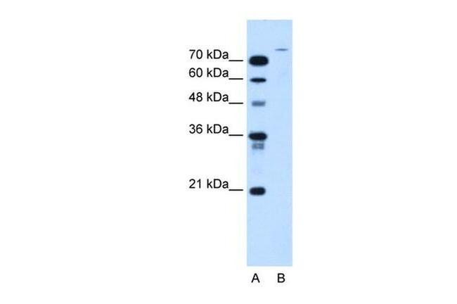 USP48 Antibody in Western Blot (WB)