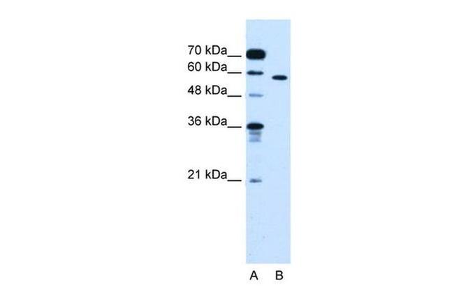 ORP9 Antibody in Western Blot (WB)