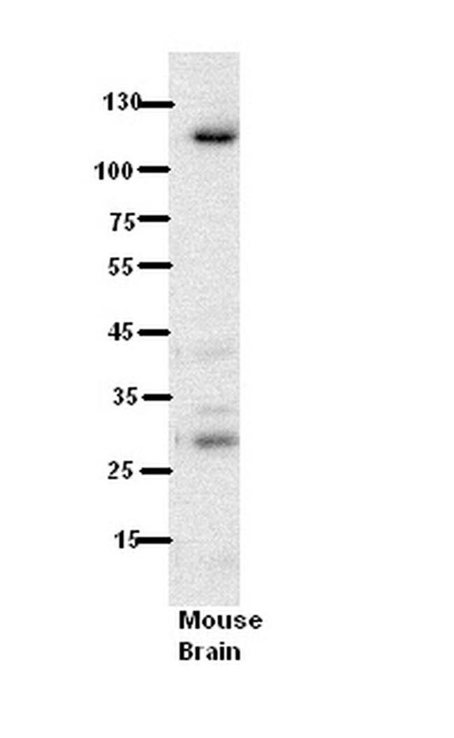 N6AMT1 Antibody in Western Blot (WB)