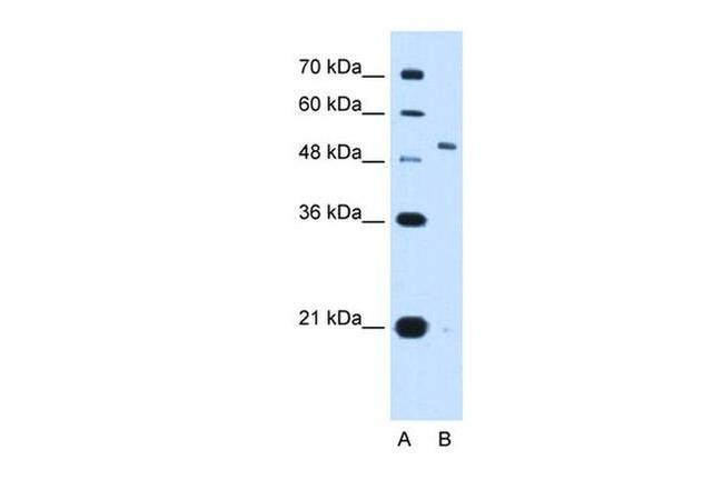 KV3.1 (KCNC1) Antibody in Western Blot (WB)