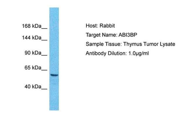 ABI3BP Antibody in Western Blot (WB)
