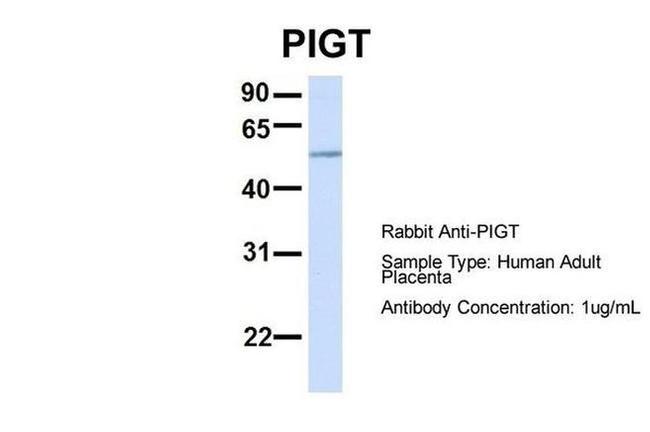 PIGT Antibody in Western Blot (WB)