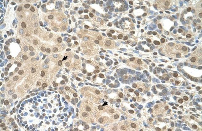 TMEM30A Antibody in Immunohistochemistry (Paraffin) (IHC (P))