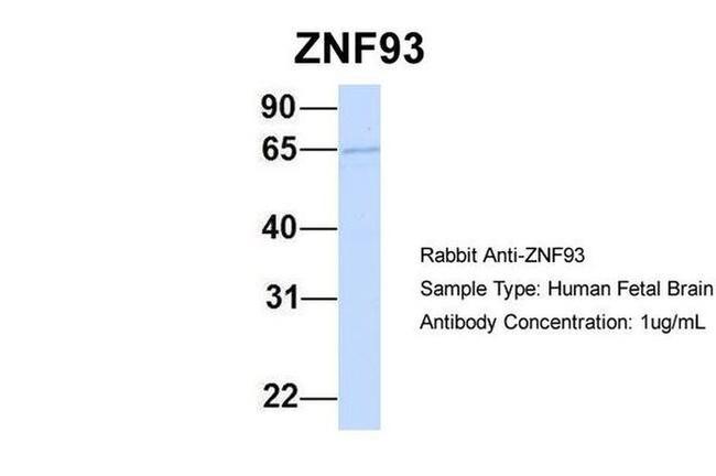ZNF93 Antibody in Western Blot (WB)
