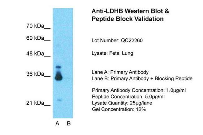 LDHB Antibody in Western Blot (WB)