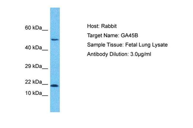 GADD45B Antibody in Western Blot (WB)