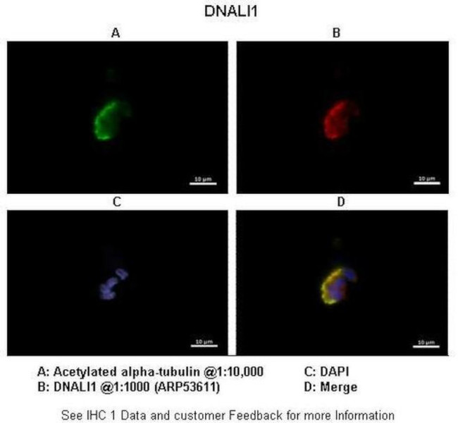DNALI1 Antibody in Immunocytochemistry (ICC/IF)