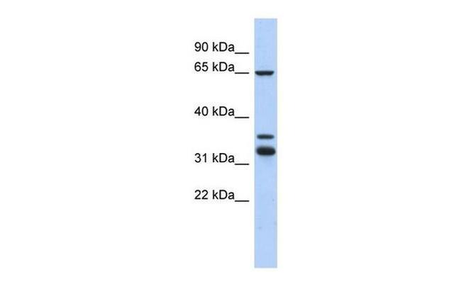S100PBP Antibody in Western Blot (WB)