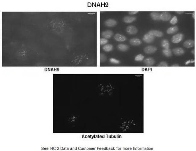 DNAH9 Antibody in Immunohistochemistry (IHC)