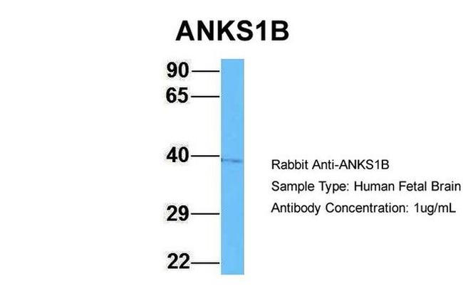 ANKS1B Antibody in Western Blot (WB)