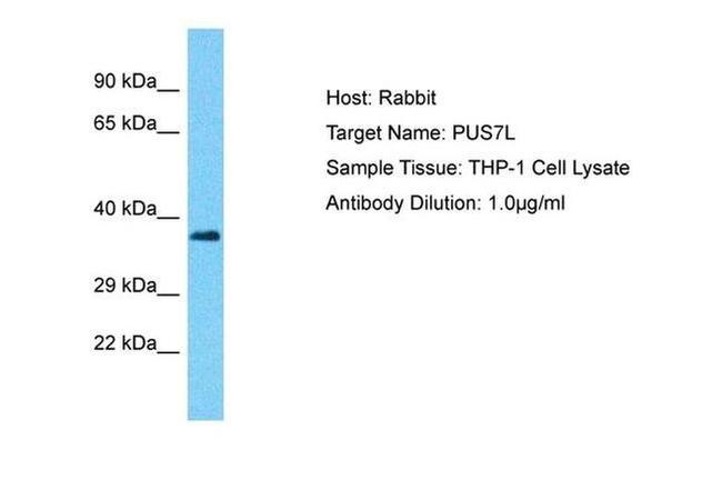 PUS7L Antibody in Western Blot (WB)