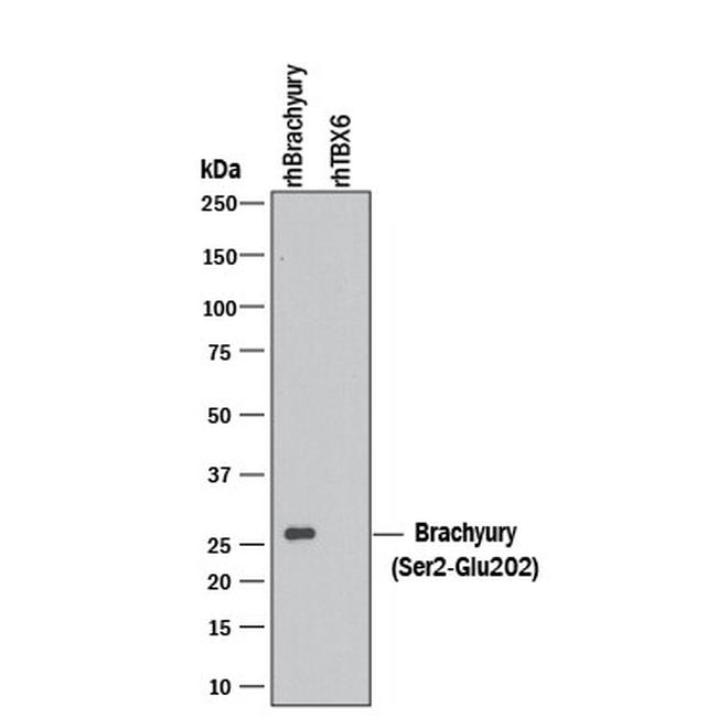 Brachyury Antibody in Western Blot (WB)