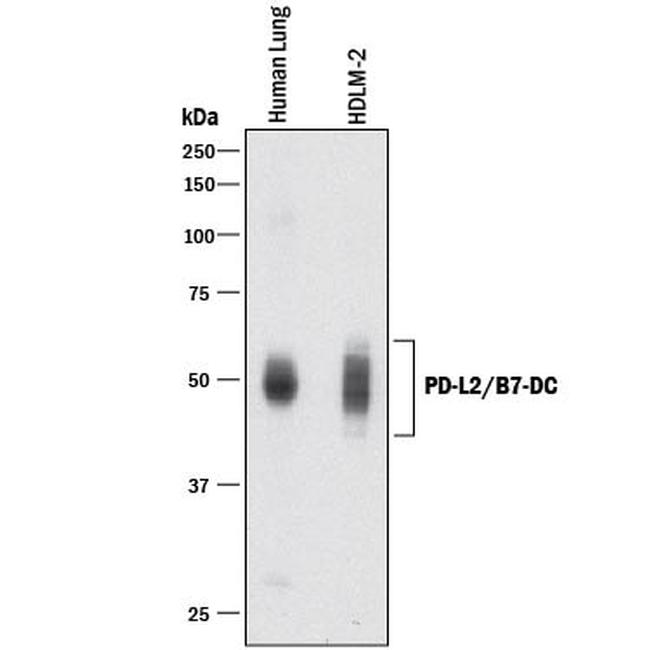 CD273 (B7-DC) Antibody in Western Blot (WB)