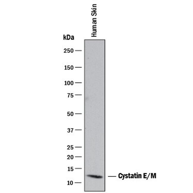Cystatin M Antibody in Western Blot (WB)