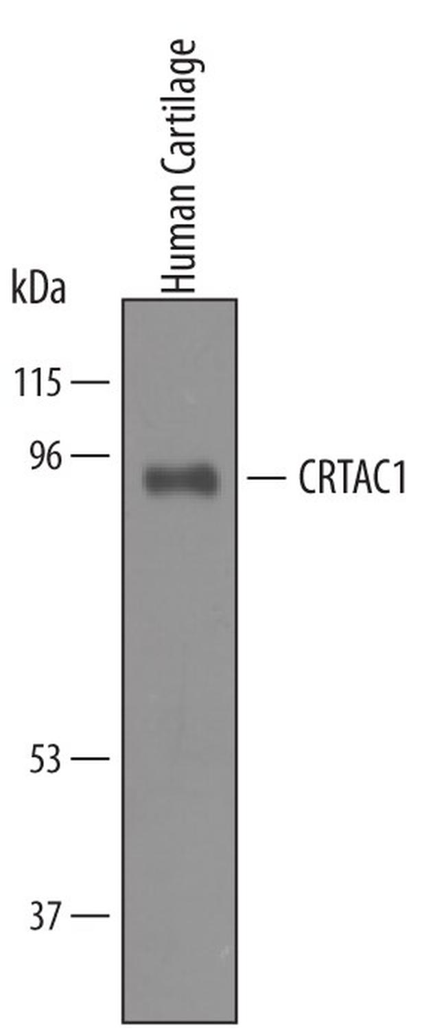CRTAC1 Antibody in Western Blot (WB)