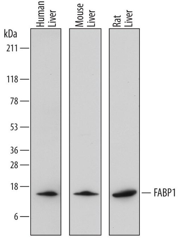 FABP1 Antibody in Western Blot (WB)