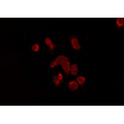 KISS1R Antibody in Immunocytochemistry (ICC/IF)