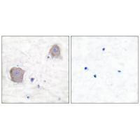 mGluR4 Antibody in Immunohistochemistry (Paraffin) (IHC (P))