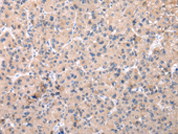 ZNF268 Antibody in Immunohistochemistry (Paraffin) (IHC (P))