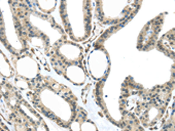 MED18 Antibody in Immunohistochemistry (Paraffin) (IHC (P))