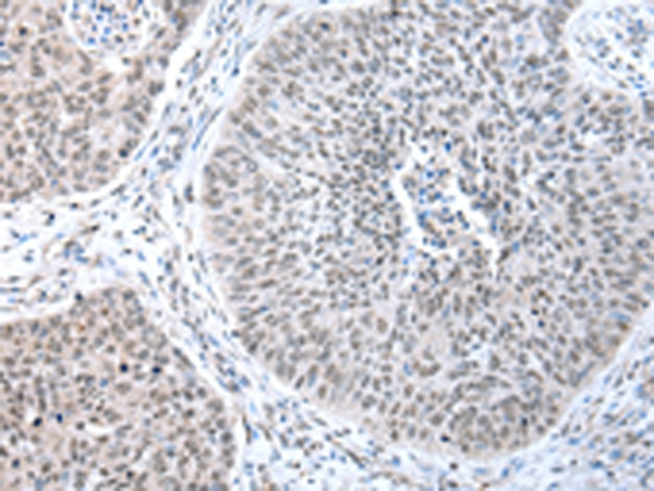 WRAP53 Antibody in Immunohistochemistry (Paraffin) (IHC (P))