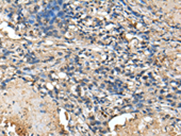 PRTFDC1 Antibody in Immunohistochemistry (Paraffin) (IHC (P))