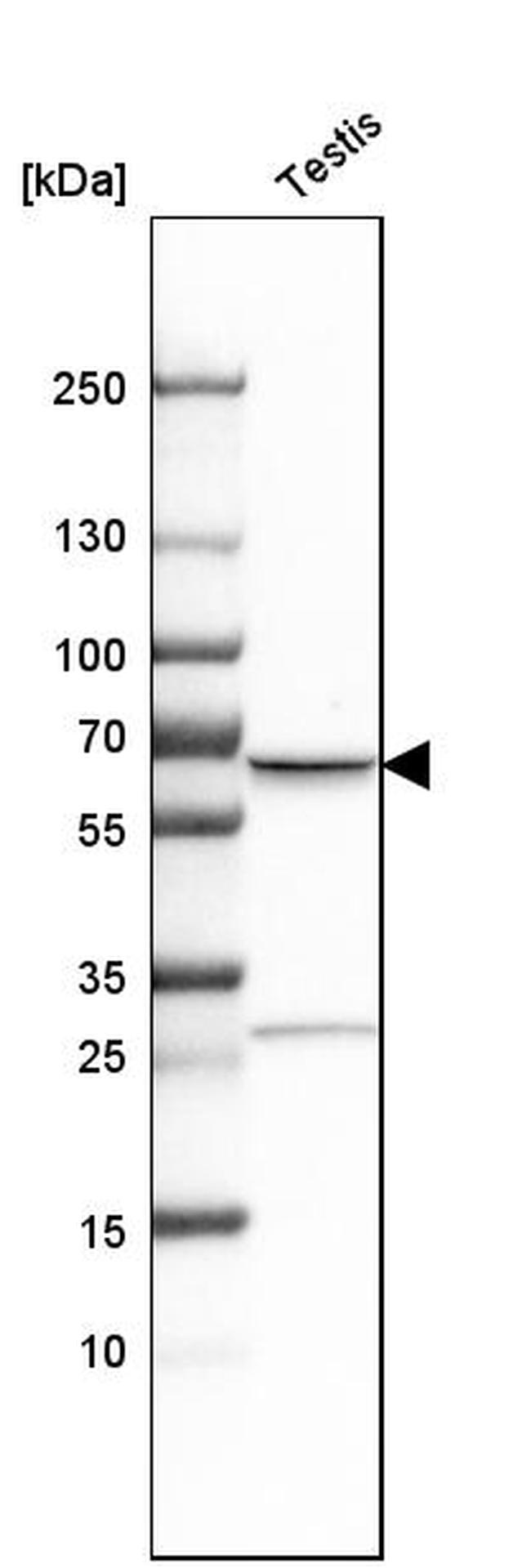 TKTL1 Antibody in Western Blot (WB)