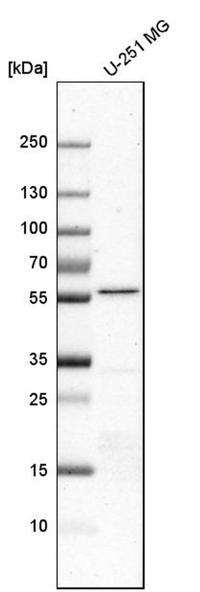 RTCB Antibody in Western Blot (WB)