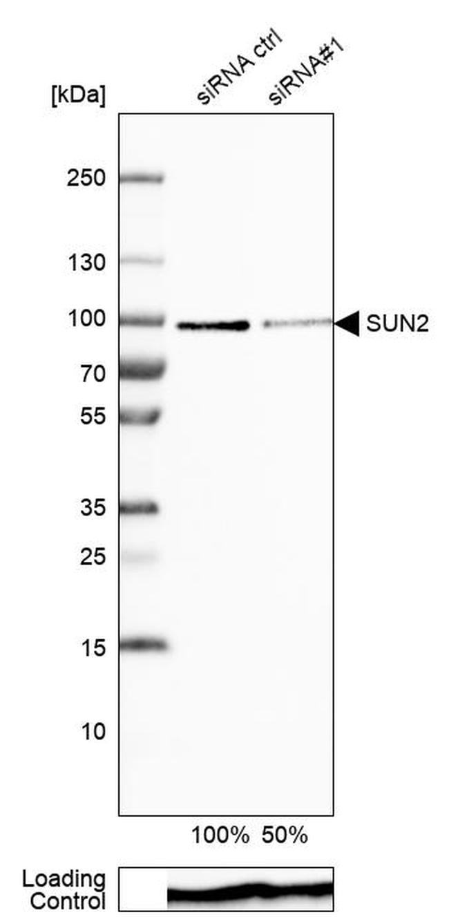 UNC84B Antibody in Western Blot (WB)