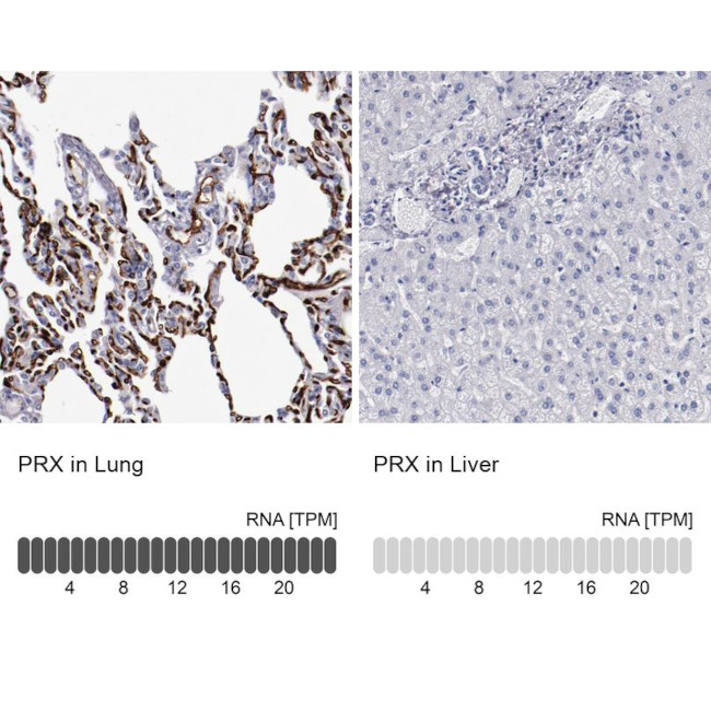 PRX Antibody in Immunohistochemistry (IHC)