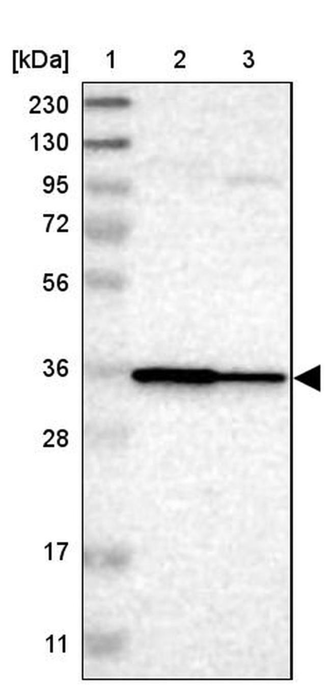 LAX1 Antibody in Western Blot (WB)