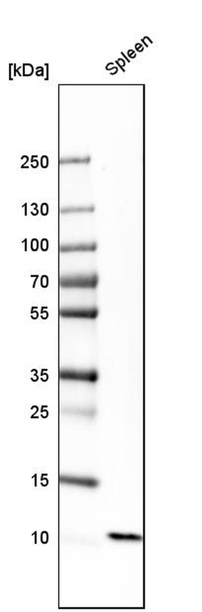 S100A12 Antibody in Western Blot (WB)