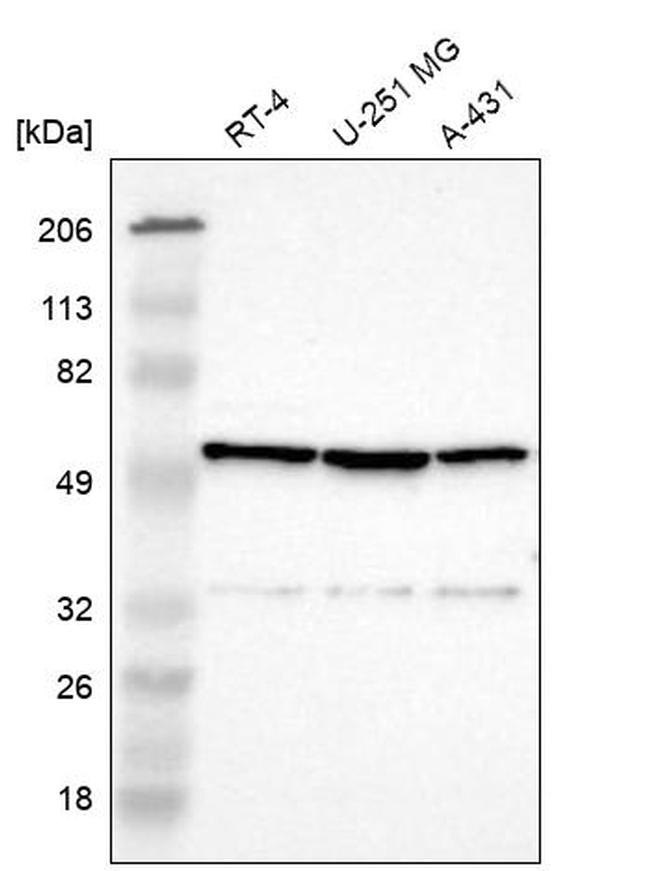 CCDC176 Antibody in Western Blot (WB)