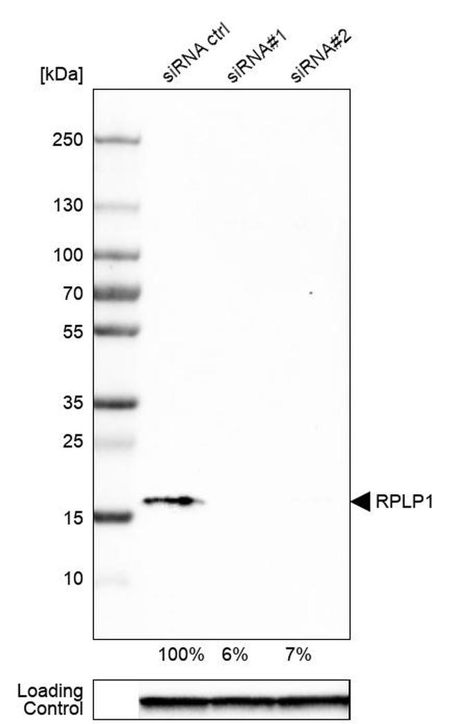 RPLP1 Antibody in Western Blot (WB)