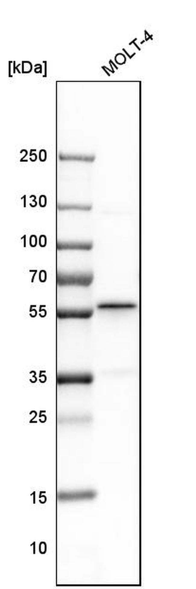 BAF57 Antibody in Western Blot (WB)
