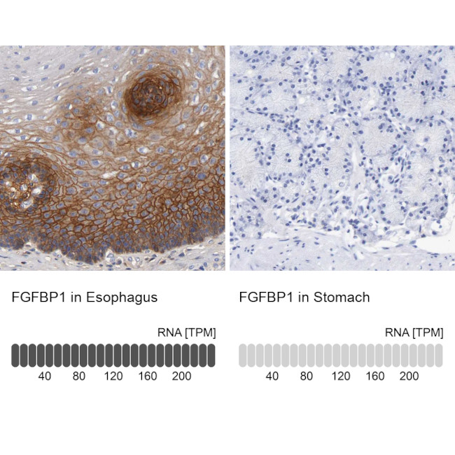 FGFBP1 Antibody in Immunohistochemistry (IHC)