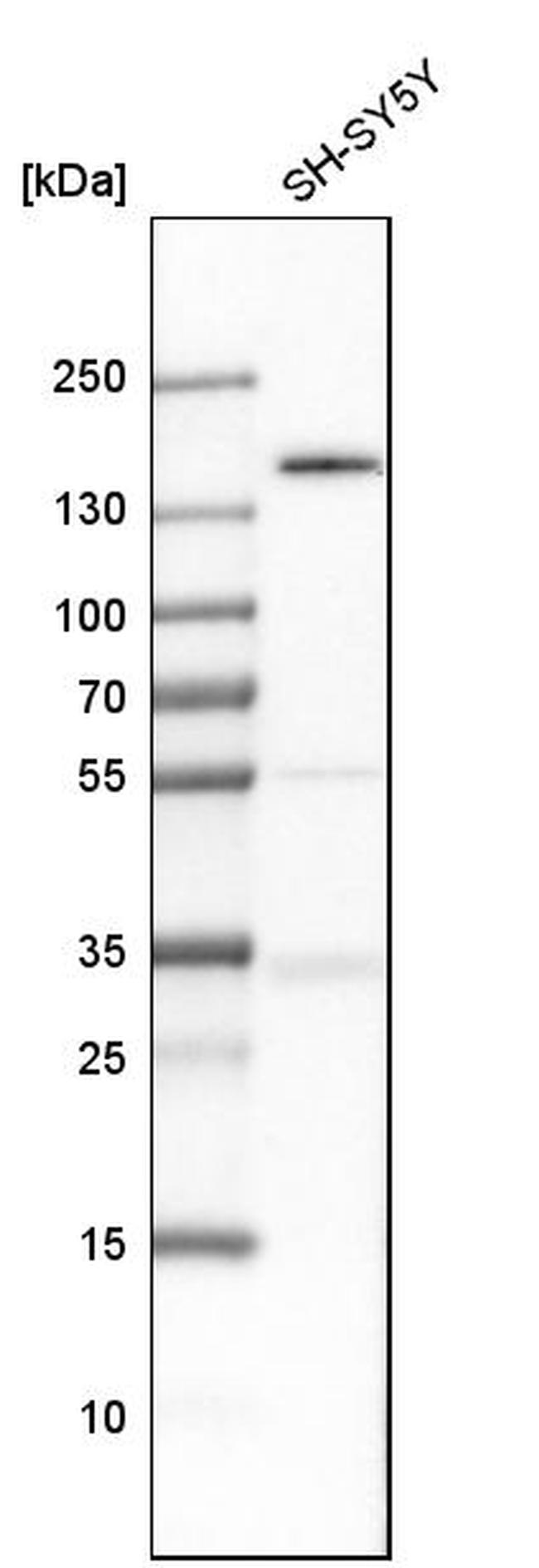 TULP4 Antibody in Western Blot (WB)