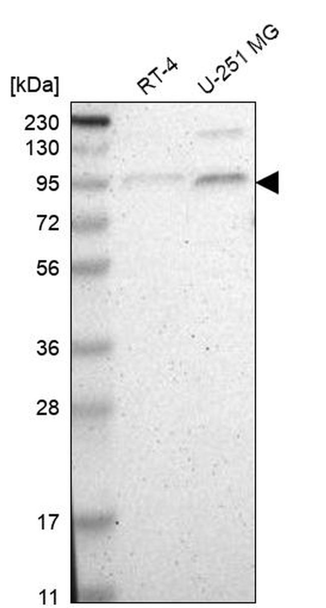 TAF5 Antibody in Western Blot (WB)
