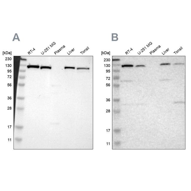 PITRM1 Antibody in Western Blot (WB)