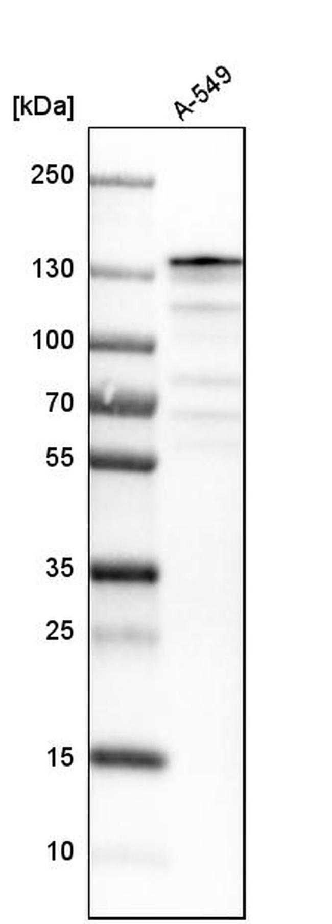 USP28 Antibody in Western Blot (WB)