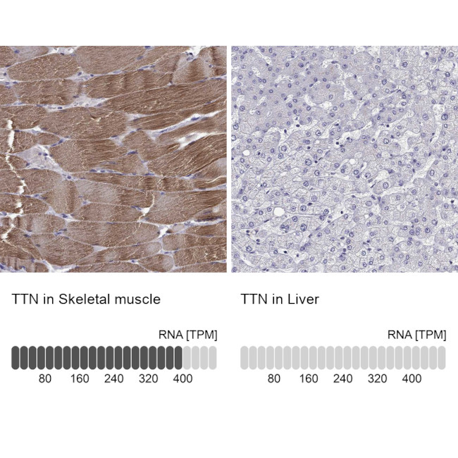 Titin Antibody in Immunohistochemistry (IHC)