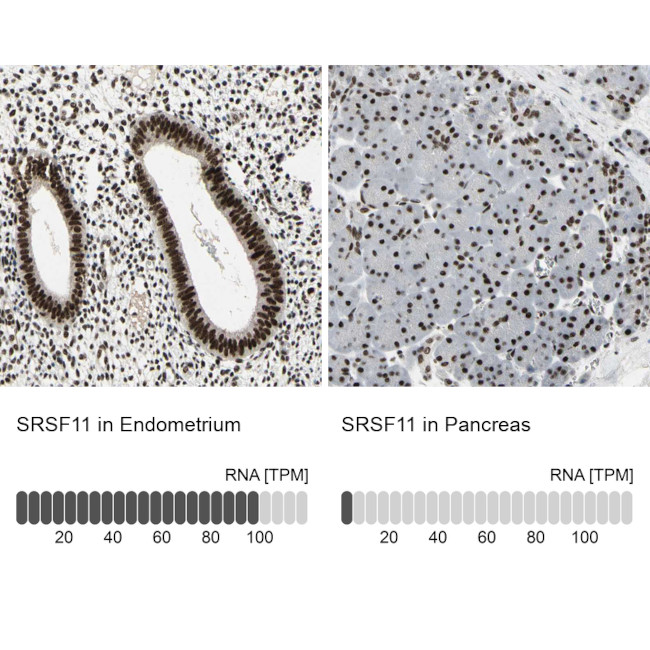 SRSF11 Antibody in Immunohistochemistry (IHC)