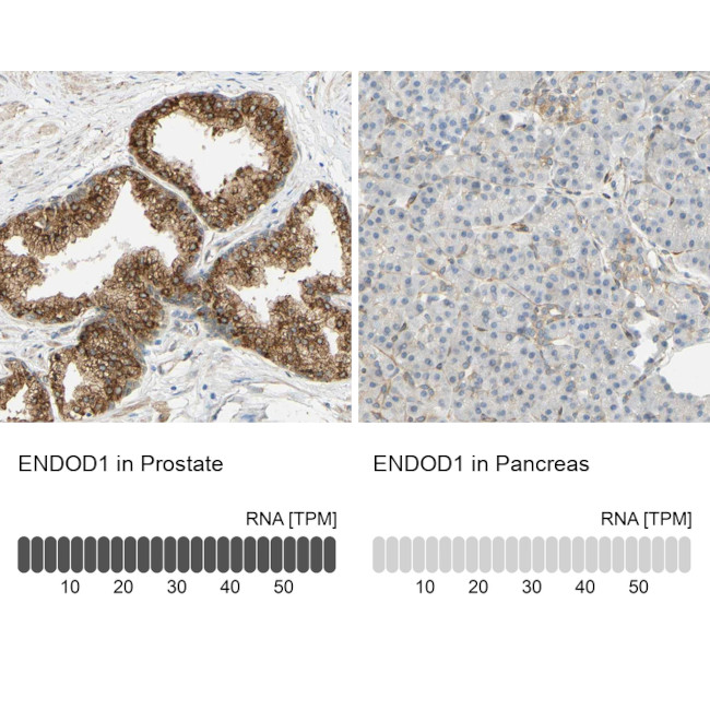 ENDOD1 Antibody in Immunohistochemistry (IHC)