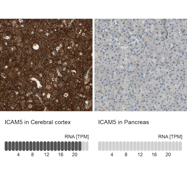 ICAM-5 Antibody in Immunohistochemistry (IHC)